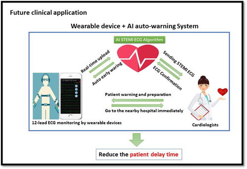 时间就是生命 同济团队领航，全球首个心梗人工智能预警系统问世